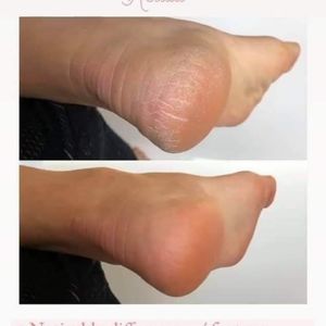 Sole Solution foot cream by Nuskin.  4.2 oz